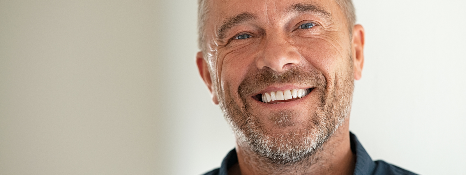 implante dental sin hueso