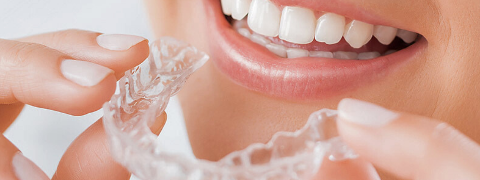 ortodoncia invisible clinica crespo